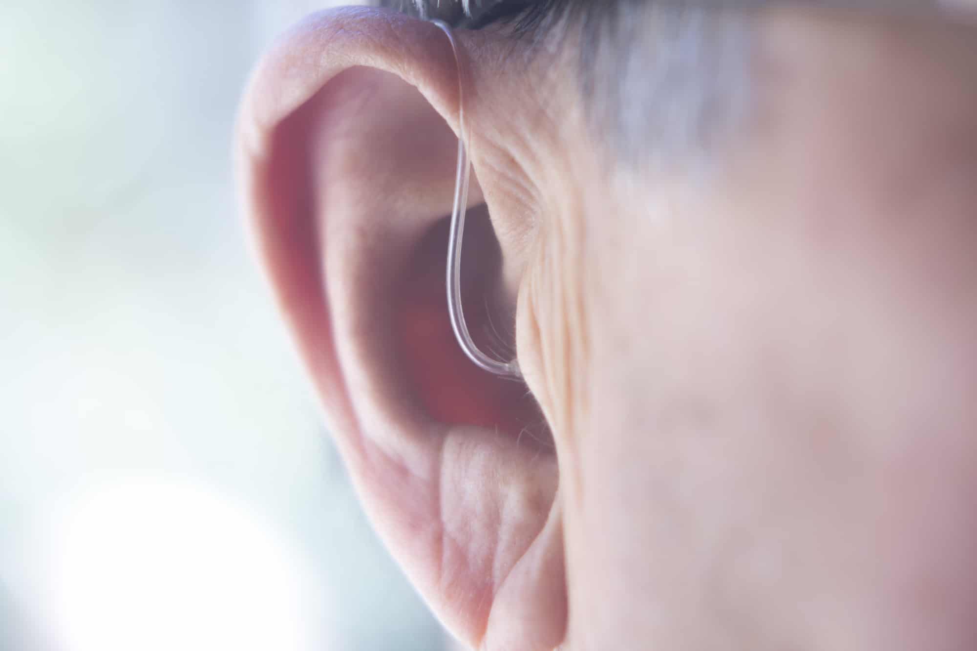 Does Medicare Cover Hearing Aids for Seniors Who Need Hearing Assistance?